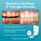 Perio Gel Periodontal Treatment for Teeth – Whitening

