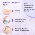Medical Grade Silicone Scar Gel for Surgical & Acne Scars

