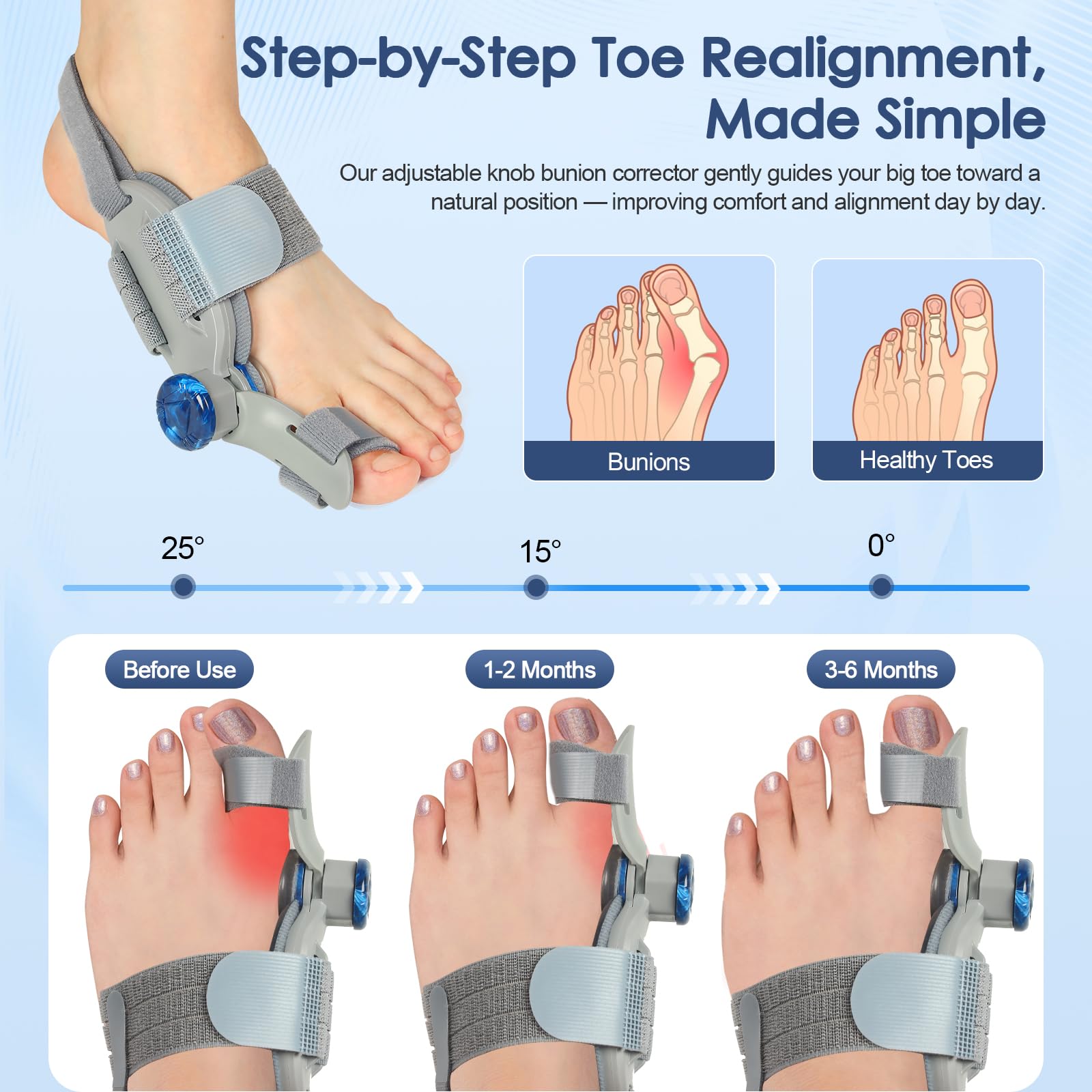 Bunion Corrector Adjustable Knob Silicone Pad

