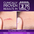 Cicatricure Advanced Scar Gel for Face & Body | Proven

