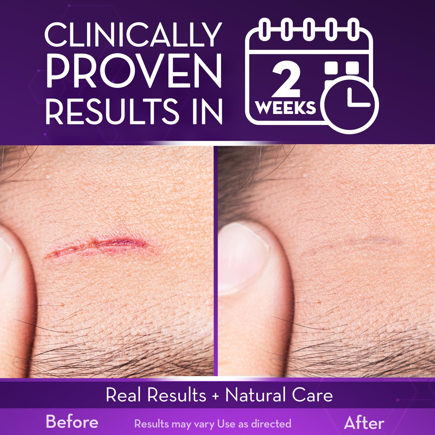 Cicatricure Advanced Scar Gel for Face & Body | Proven

