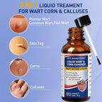 Wart Remover Liquid for Warts

