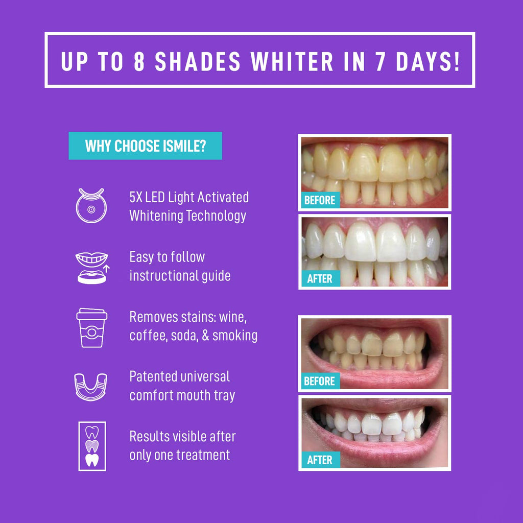 iSmile Teeth Whitening Kit for At-Home Use

