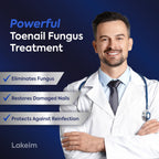 Toenail Fungus Treatment with Undecylenic Acid & Tea Tree

