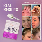 Live Conscious Collagen Peptides Powder – Type I & III

