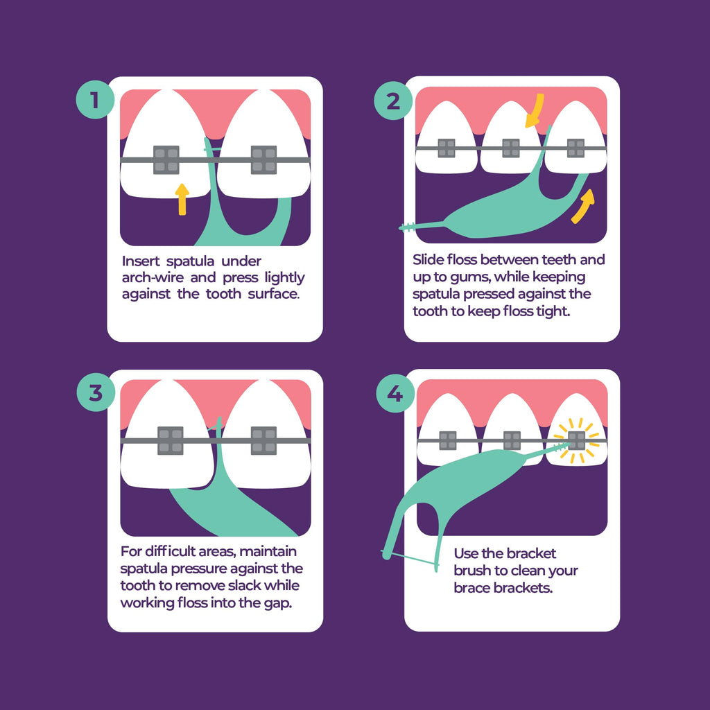 Platypus Orthodontic Flossers for Braces | Safe & Efficient

