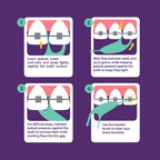 Platypus Orthodontic Flossers for Braces | Safe & Efficient

