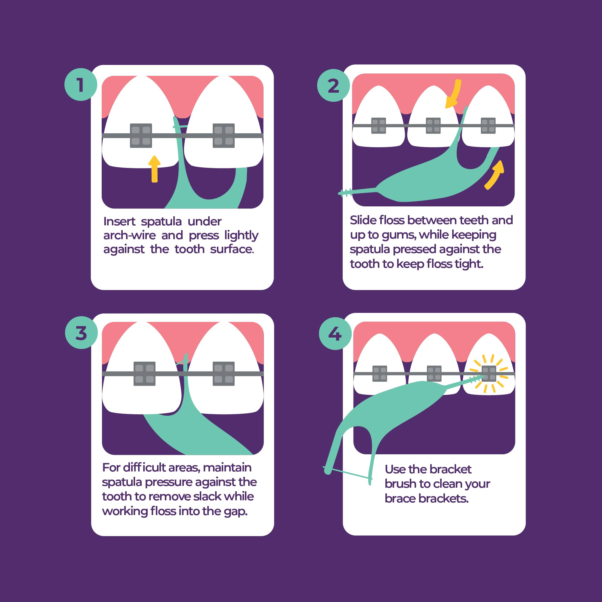 Platypus Orthodontic Flossers for Braces | Safe & Efficient

