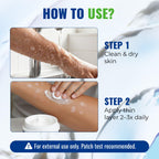 CHARMPOO 2% Miconazole Cream for Jock Itch & Ringworm

