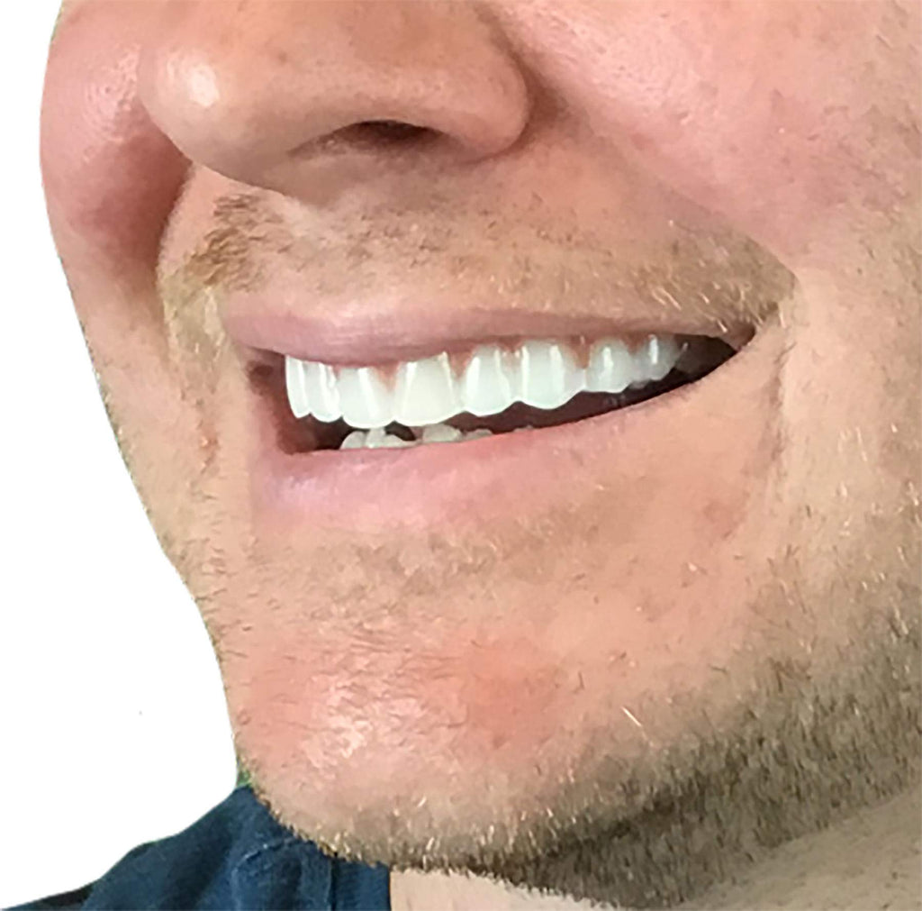 Instant Smile Comfort Fit Flex Teeth - Natural Look


