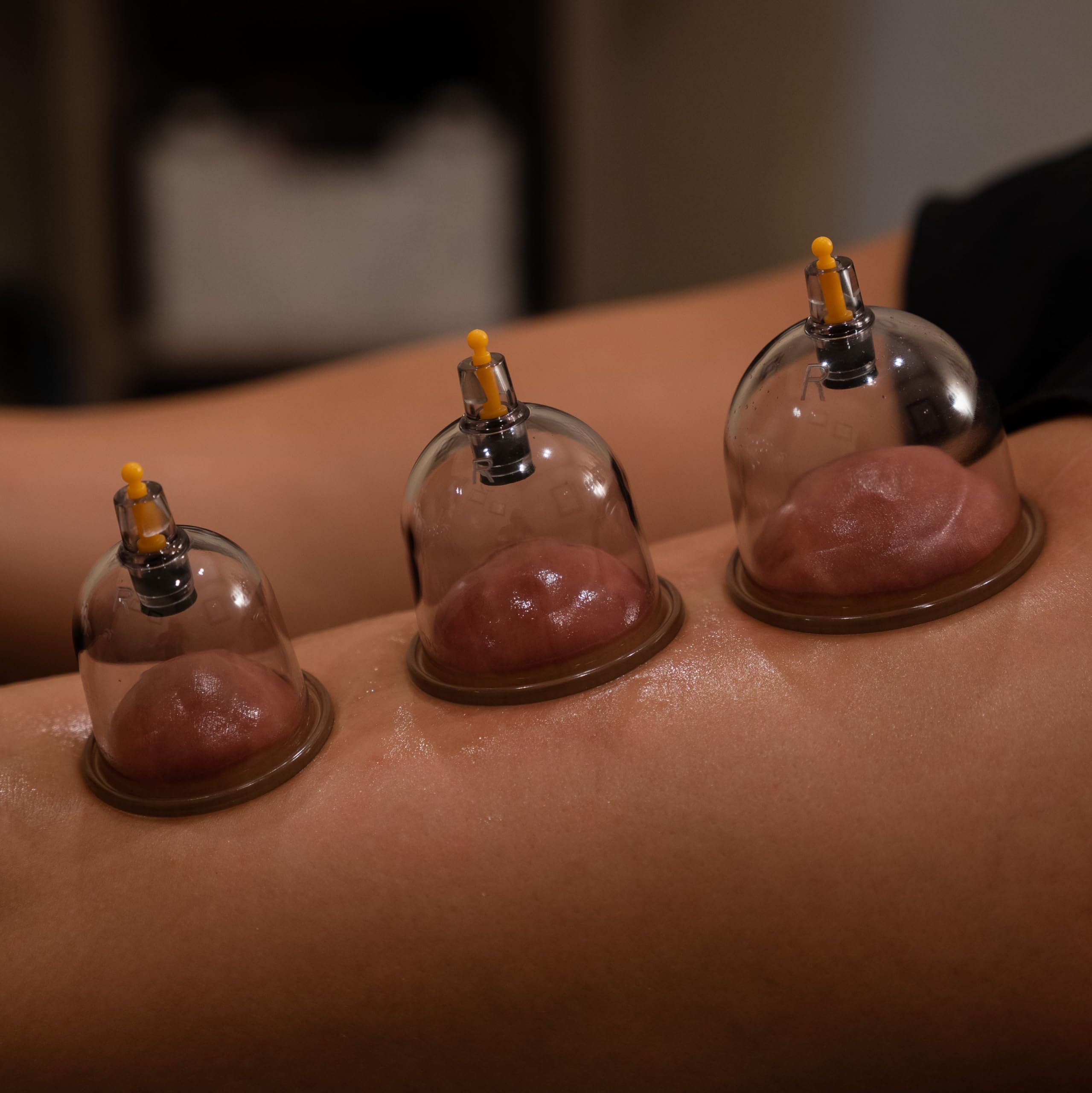Myofascial Releaser Cupping Therapy Set for Therapists

