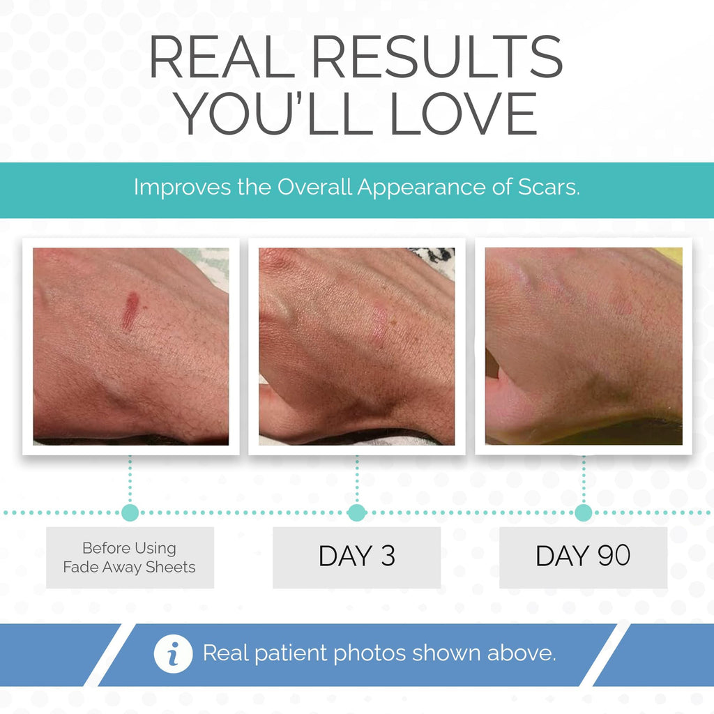 Silicone Sheets for Postoperative Skin Care

