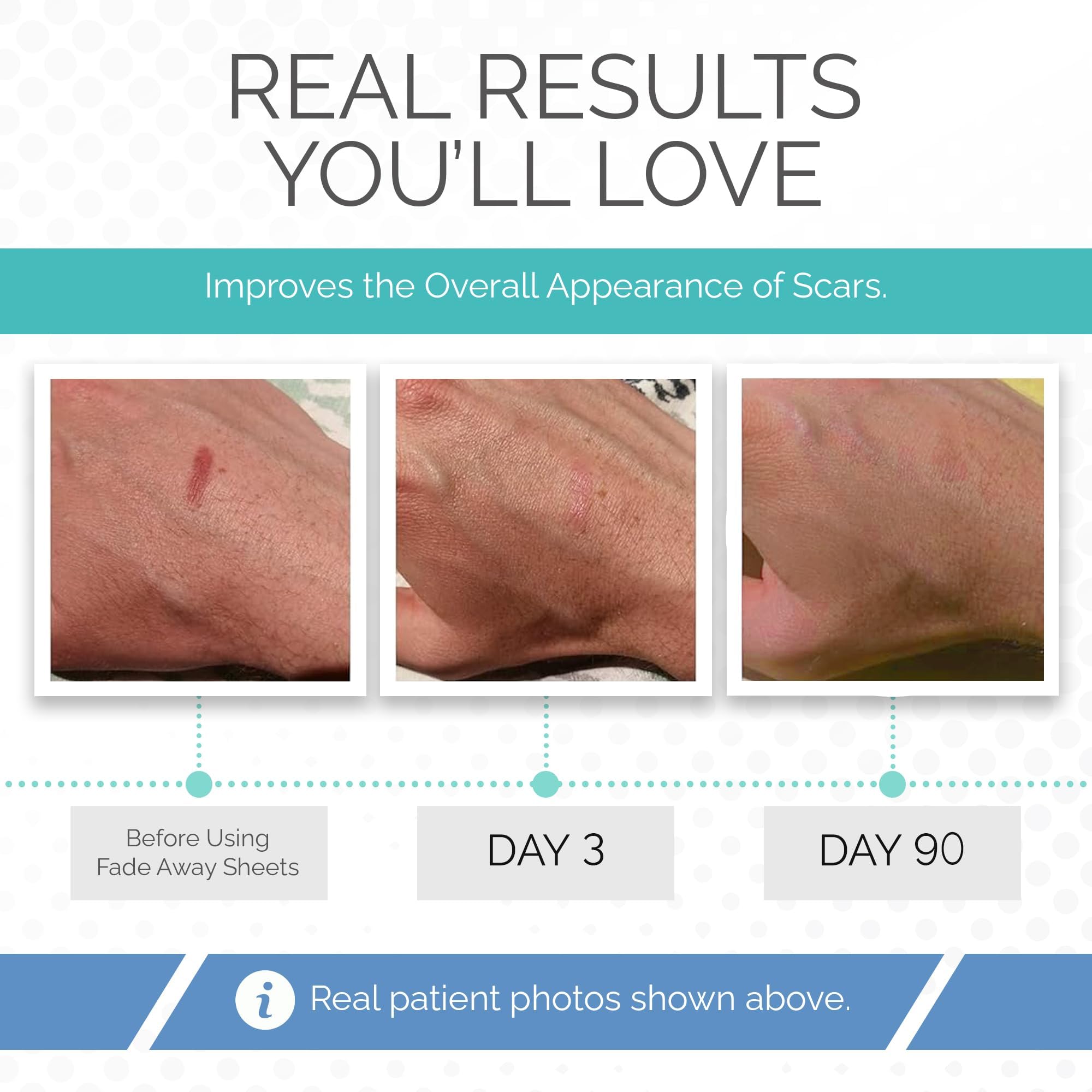 Silicone Sheets for Postoperative Skin Care


