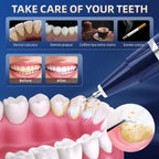 Plaque Remover for Teeth - Tartar Cleaning Kit

