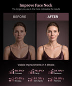 INTEO Red Light Therapy Mask for Face & Neck - 680 LEDs

