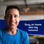 Compound W Skin Tag Remover Kit - FDA Cleared


