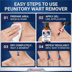 Peunitory Wart Remover Liquid - Fast-Acting Maximum Strength

