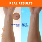 Zevo On-Body Tick & Mosquito Repellent Spray - Eight Hour

