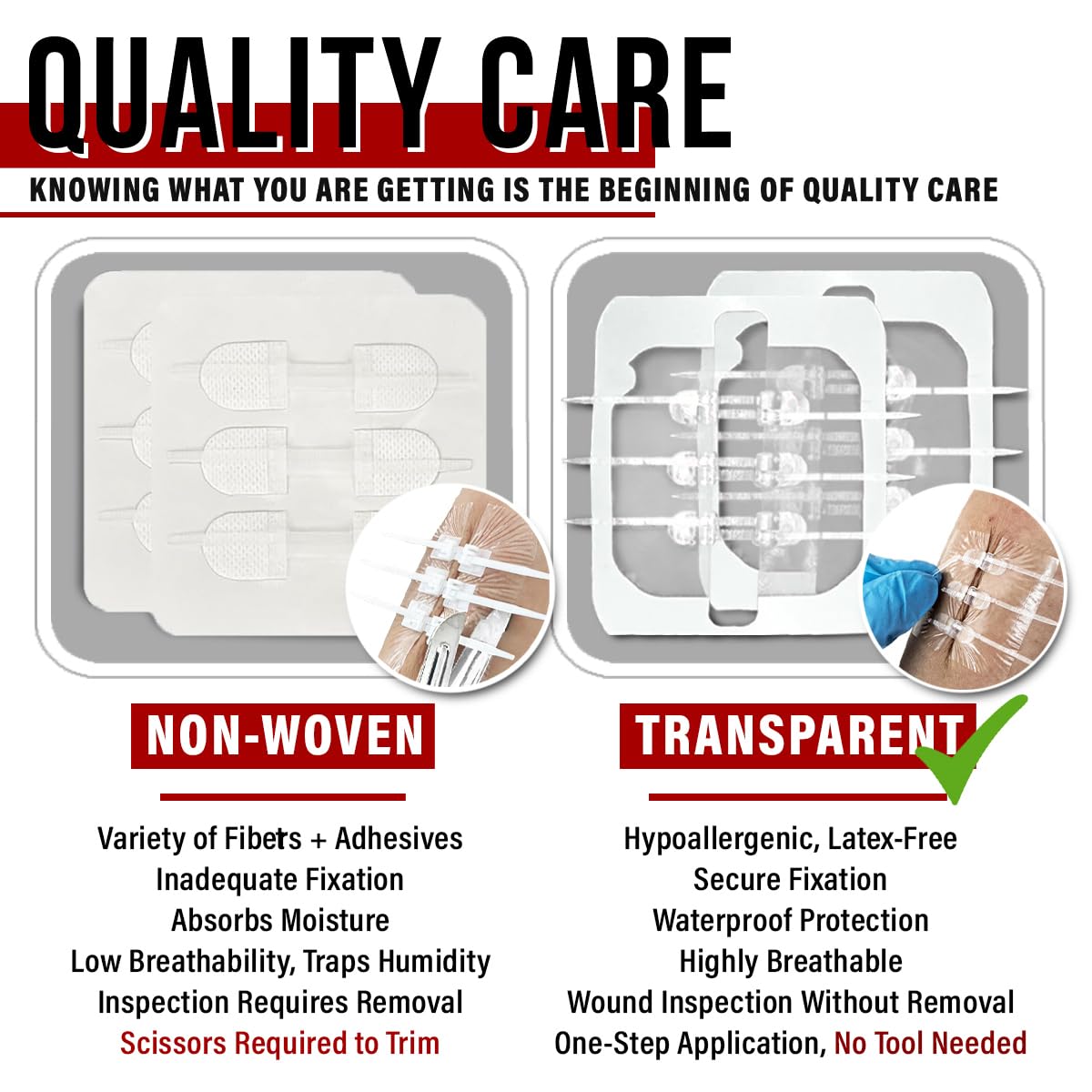 EVERLIT Wound Closure System | Suture-Free Zip-Stitch

