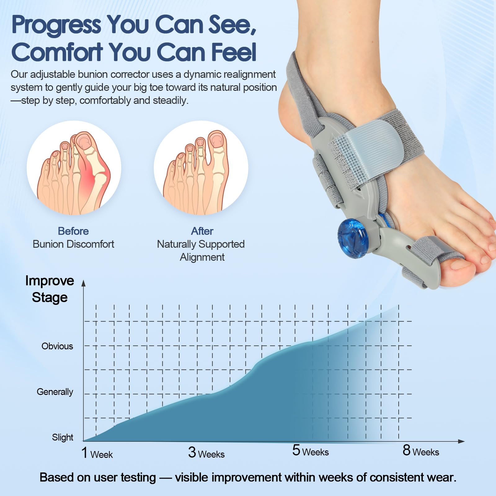 Bunion Corrector Adjustable Knob Silicone Pad

