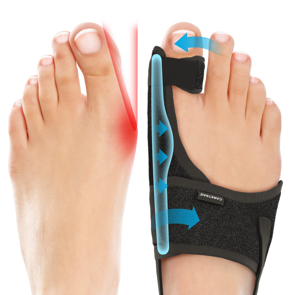 Caretras Bunion Corrector | Toe Alignment & Comfort

