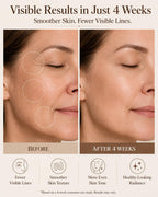 Cordless LED Face Mask for Light Therapy - 4 Wavelengths

