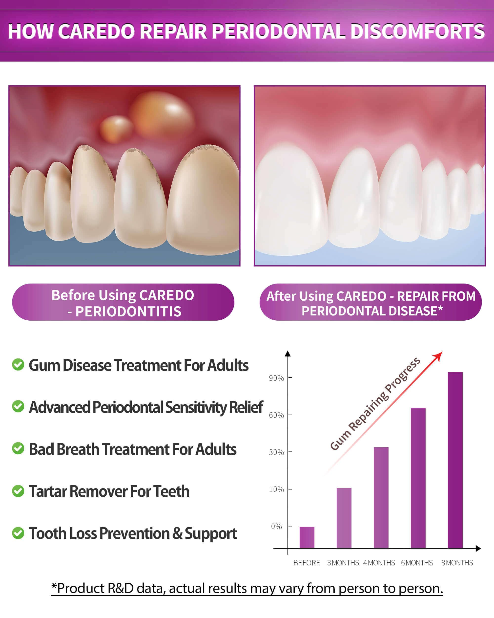 CAREDO Gum Disease Toothpaste for Periodontal Health

