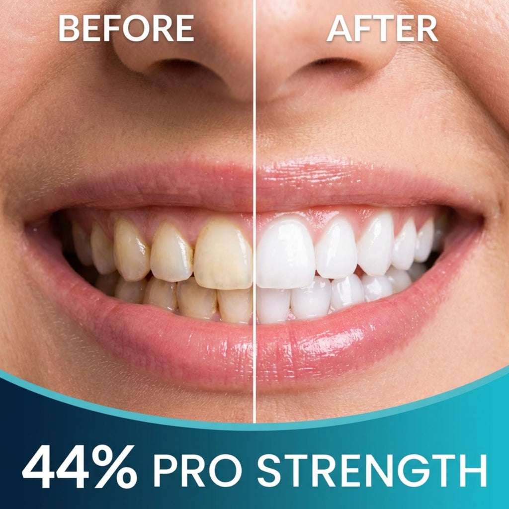 Teeth Whitening Kit for Trays - Enamel Safe At-Home Whitening

