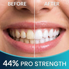 Teeth Whitening Kit for Trays - Enamel Safe At-Home Whitening

