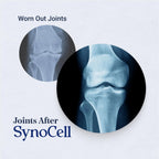 Synocell Glucosamine Chondroitin Complex for Joint Support

