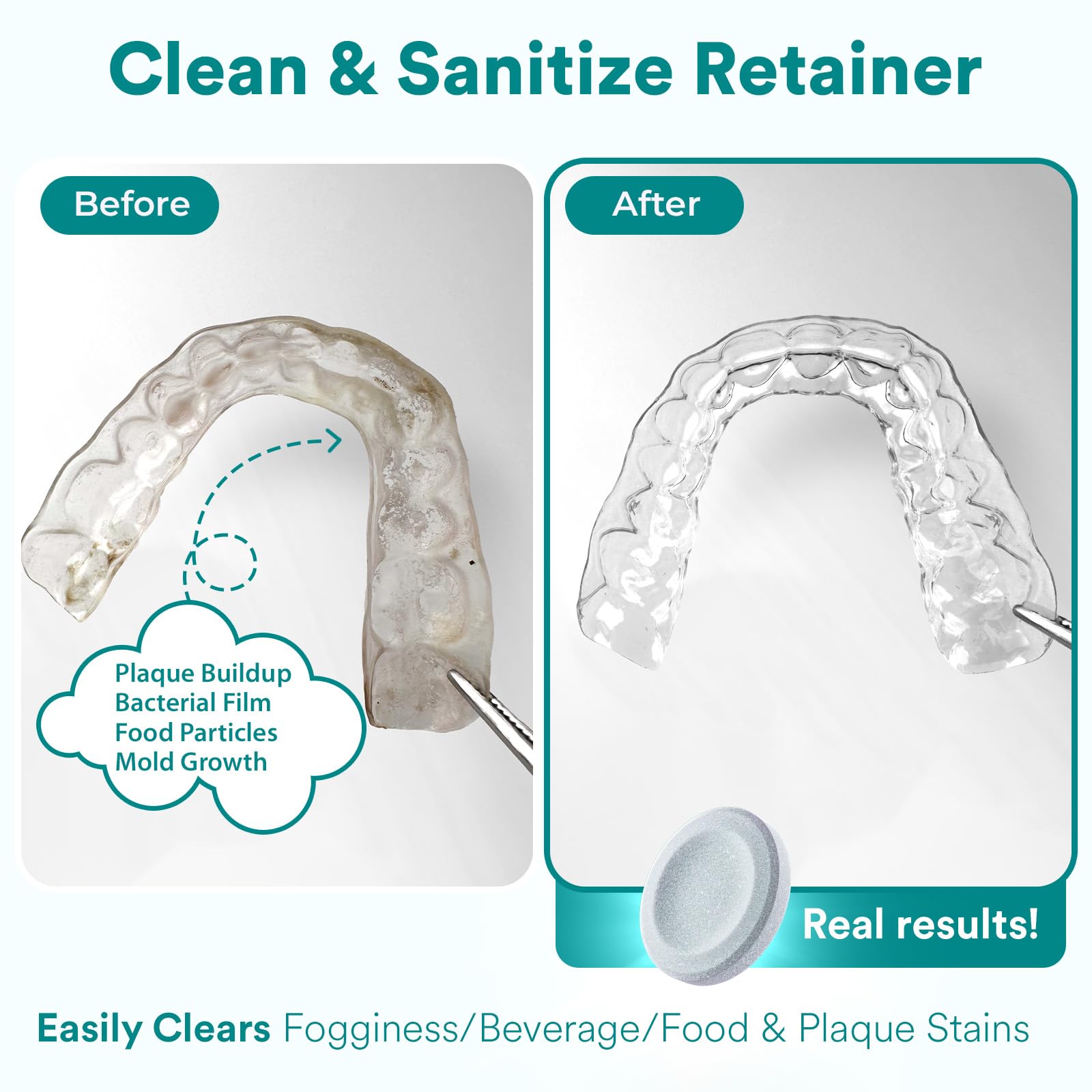 Weiss Naturals Retainer Cleaner Tablets for Invisalign

