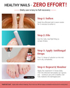 Toenail Fungus Treatment Extra Strength with 25% Undecylenic

