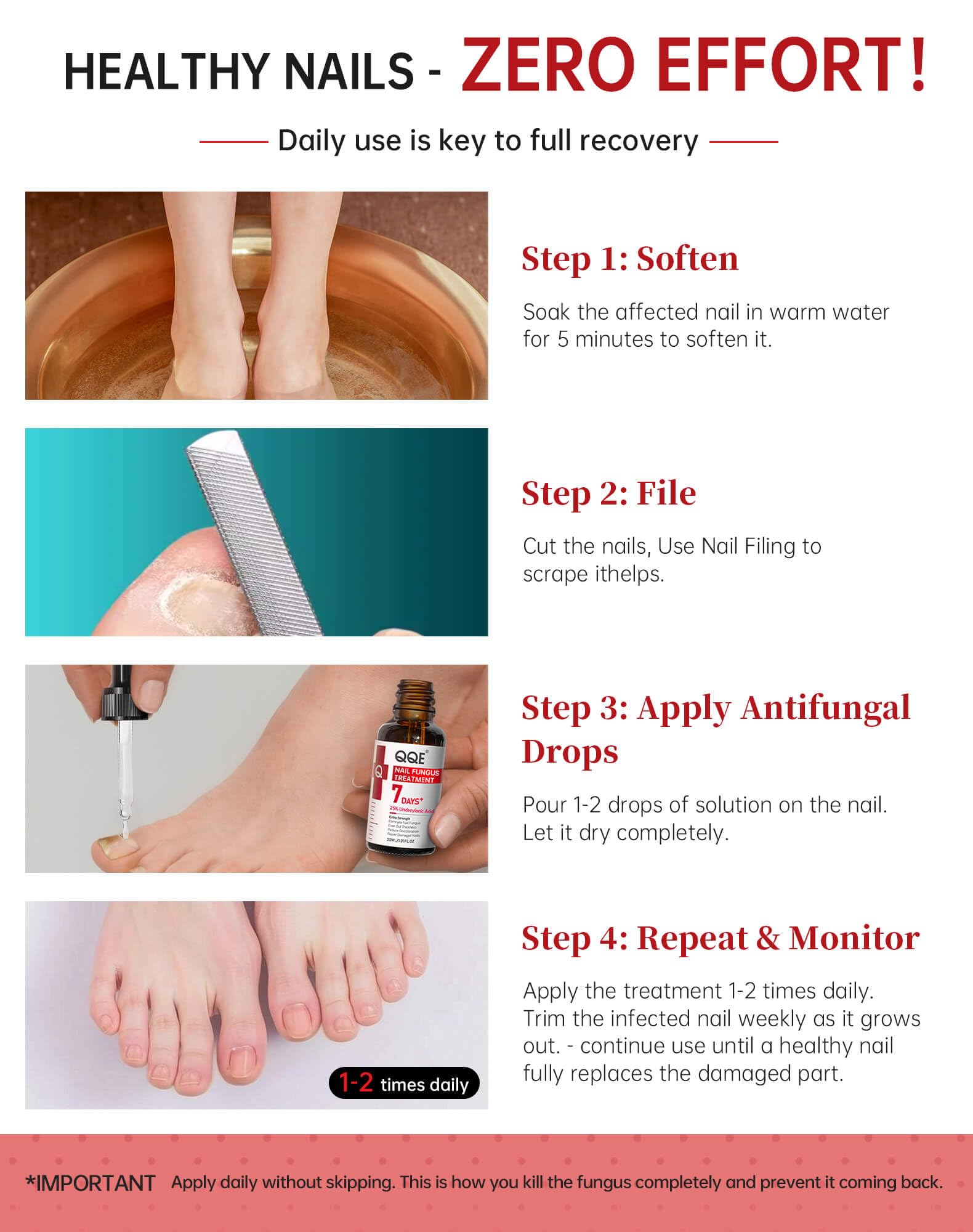 Toenail Fungus Treatment Extra Strength with 25% Undecylenic

