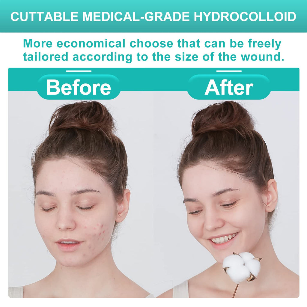 Dimora Hydrocolloid Wound Dressing - Ultra Thin Patch

