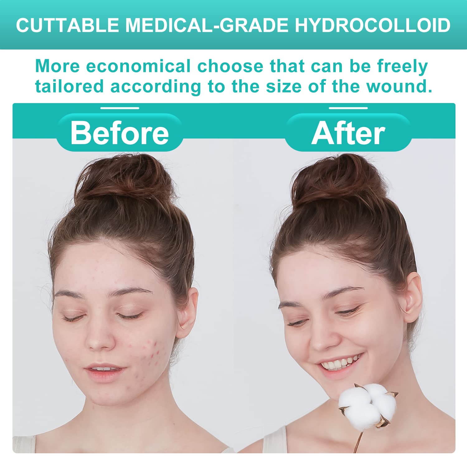 Dimora Hydrocolloid Wound Dressing - Ultra Thin Patch

