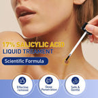 Wart Remover Liquid for Warts

