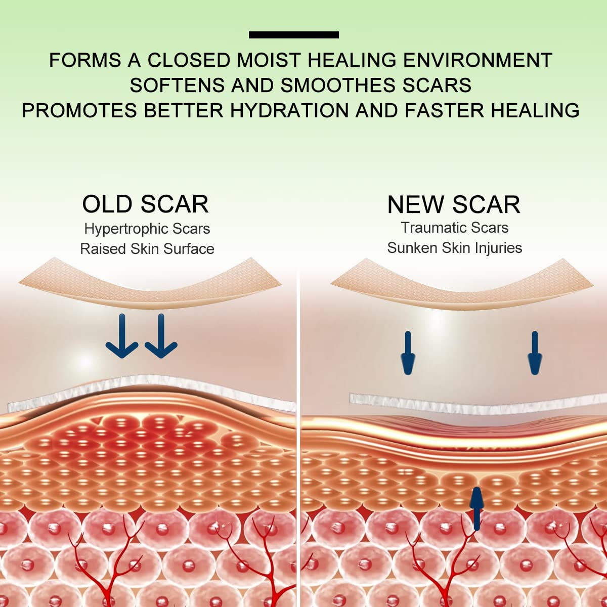 Medical Grade Silicone Therapy for Skin Healing


