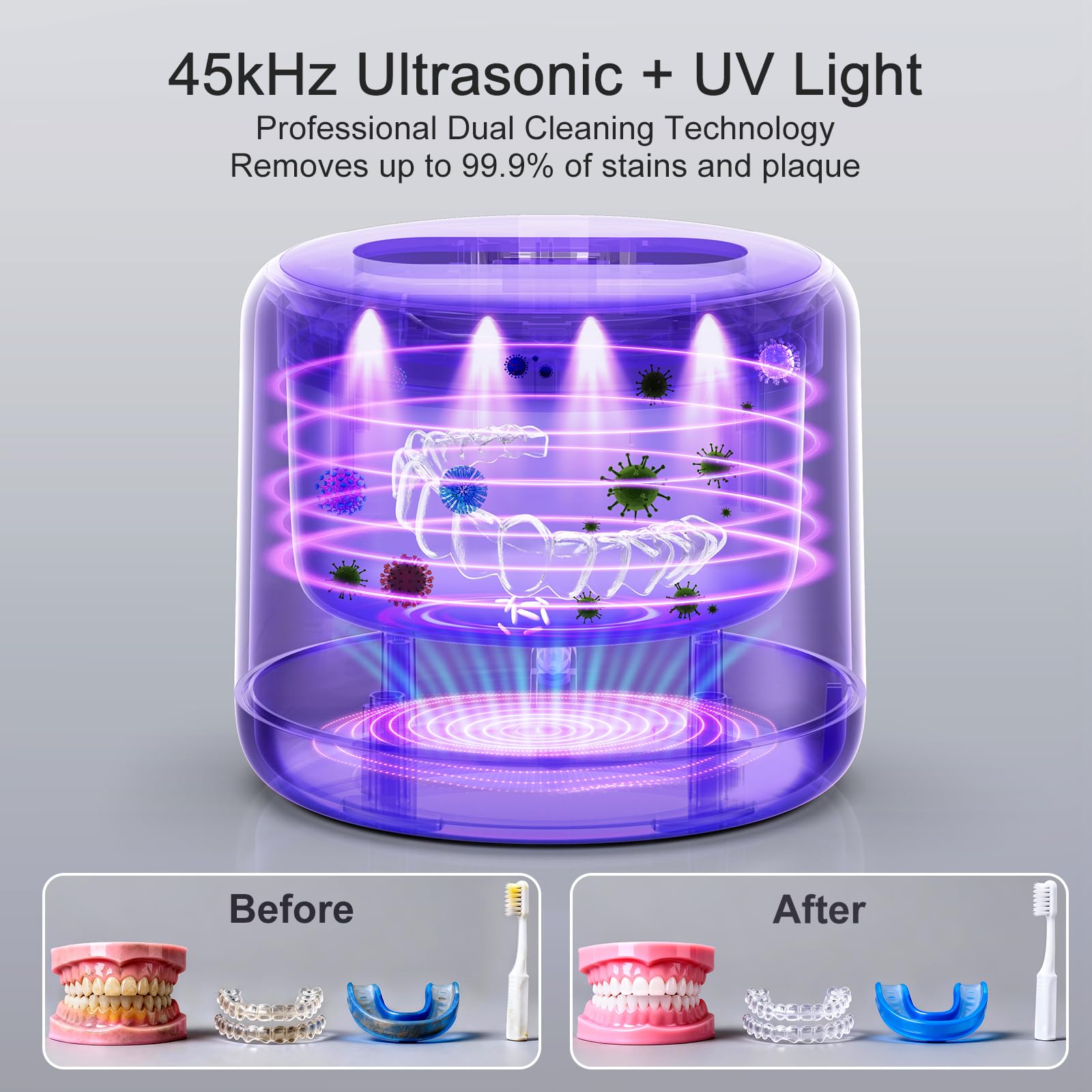 Ultrasonic Retainer Cleaner Machine – IPX6 UV Light

