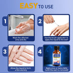 Wart Remover Liquid for Warts

