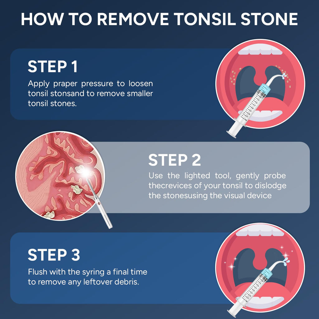 Tonsil Stone Remover with Camera - 1080P Visual Kit

