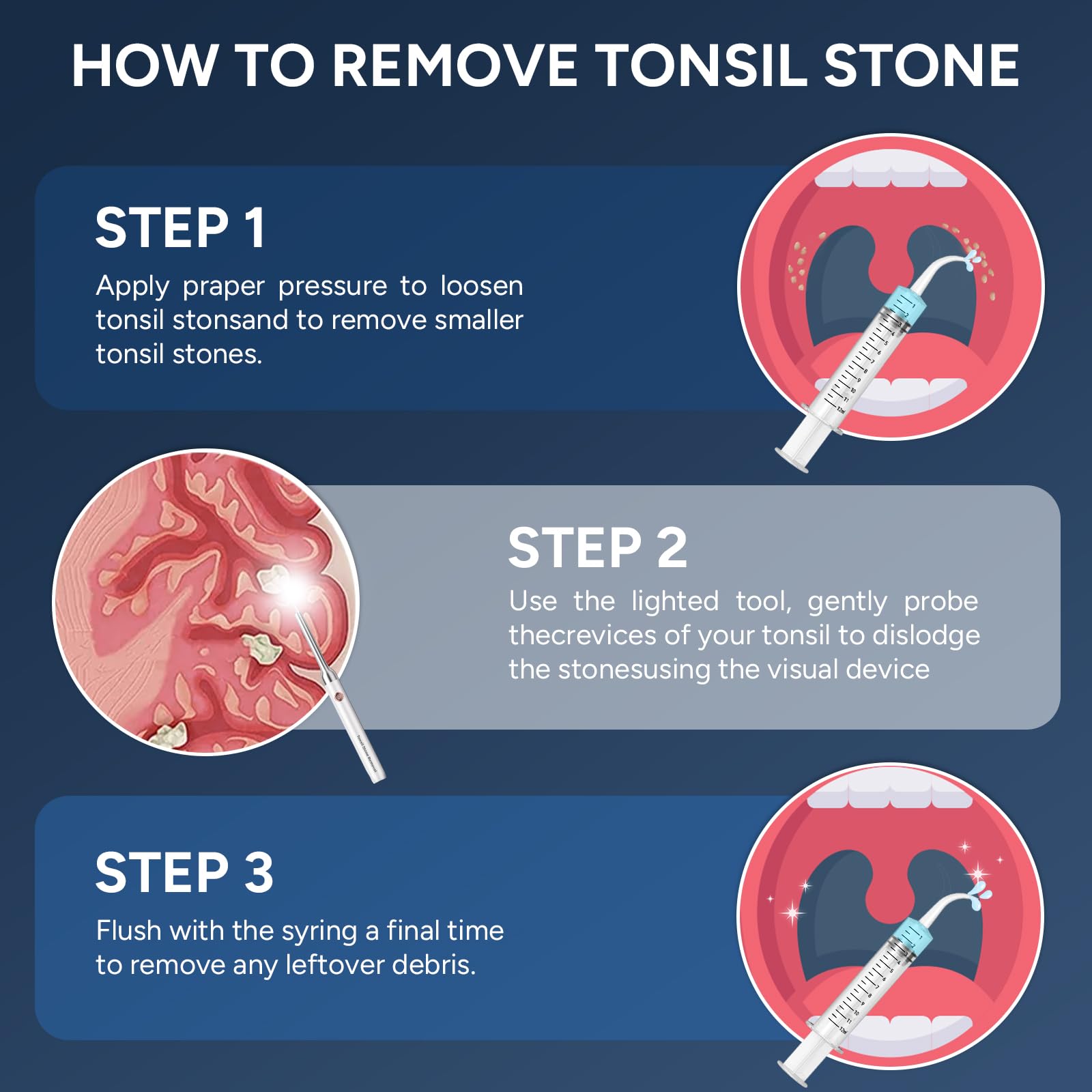 Tonsil Stone Remover with Camera - 1080P Visual Kit

