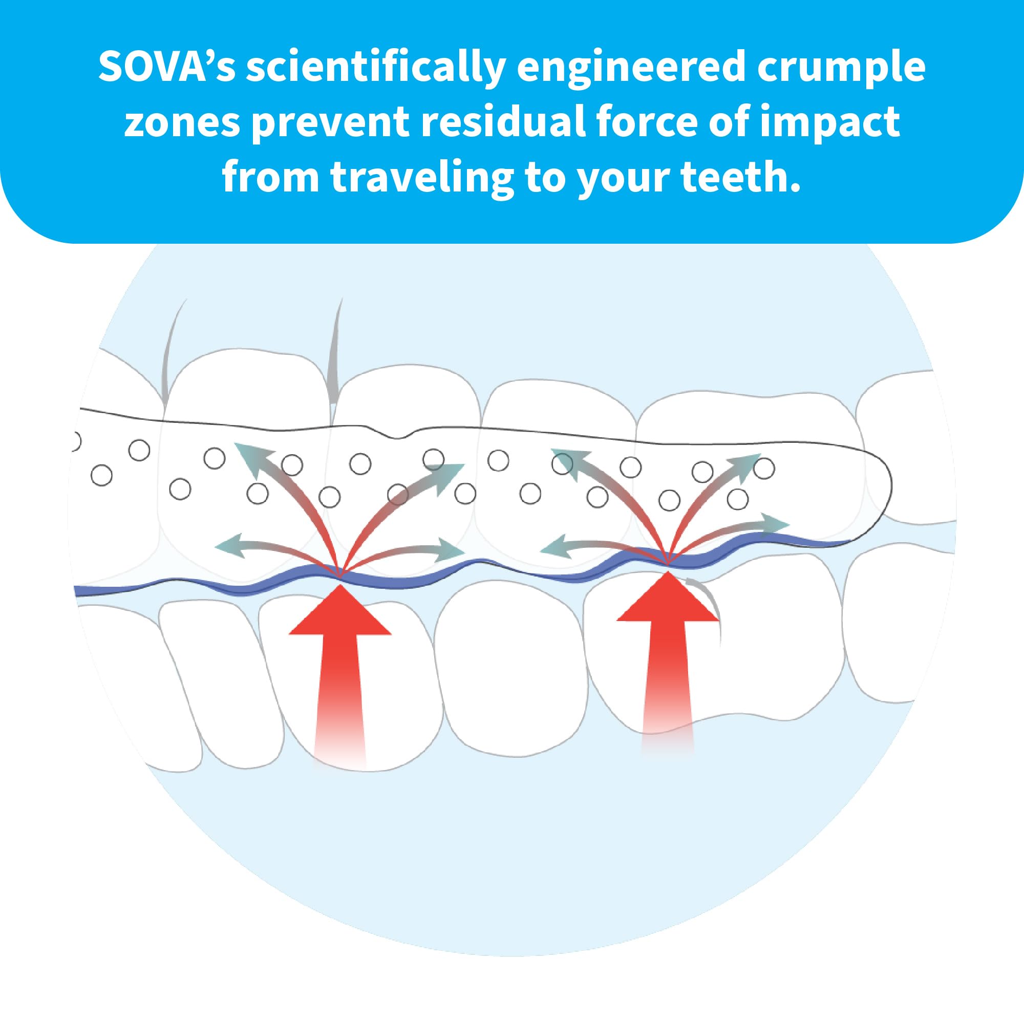 SOVA Aero Night Guard with Case | Teeth Grinding Protection

