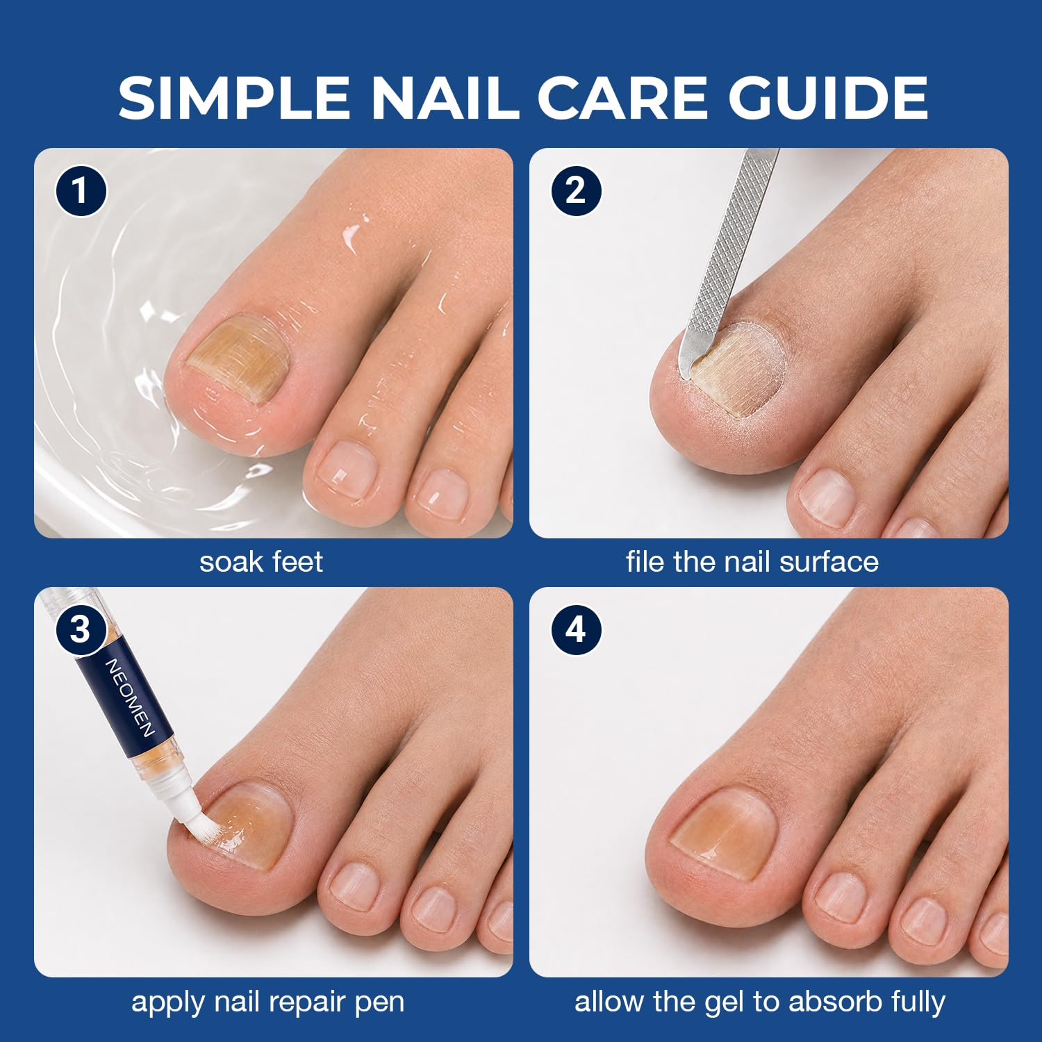 Nail Fungus Pen - Toenail & Fingernail Treatment

