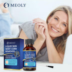 MEOLY Wart Remover - Fast-Acting Maximum Strength

