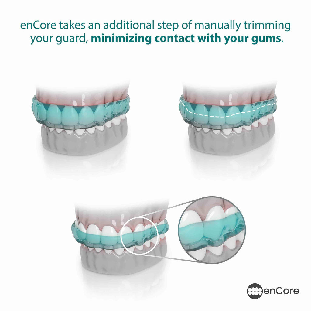 Encore Night Guard for Bruxism – Custom DIY Impression Kit

