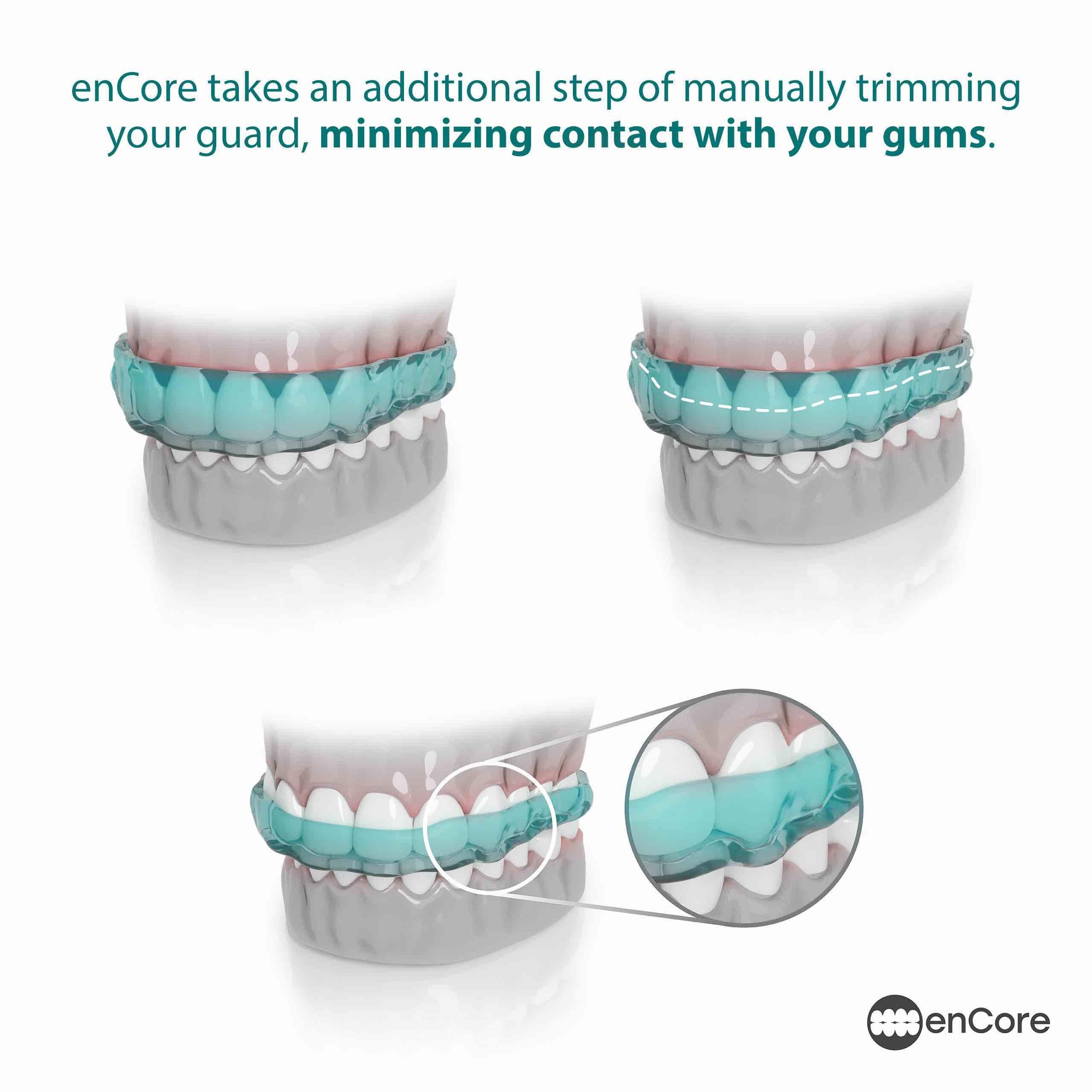 Encore Night Guard for Bruxism – Custom DIY Impression Kit

