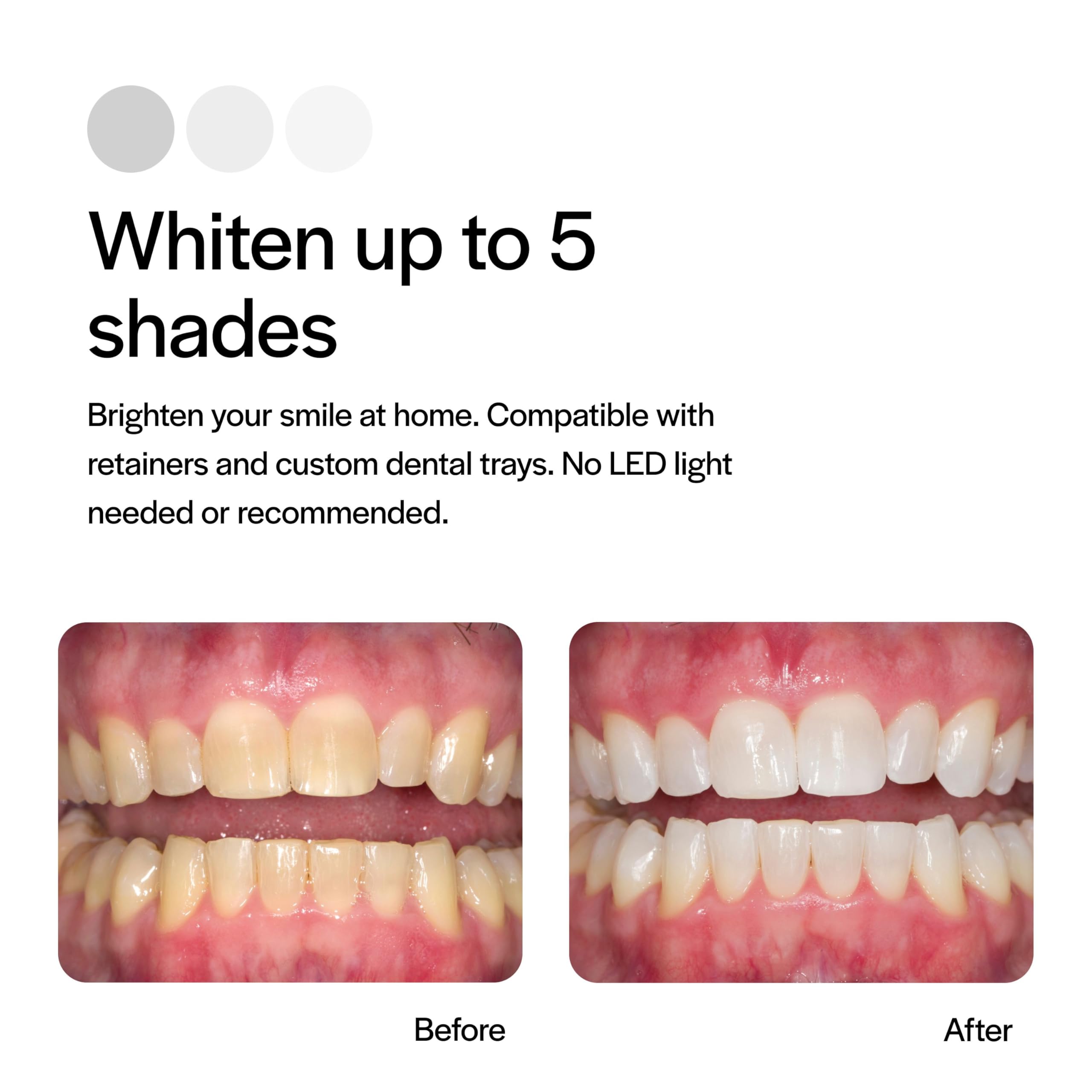 Opalescence 15% Teeth Whitening Gel Refills by Ultralent

