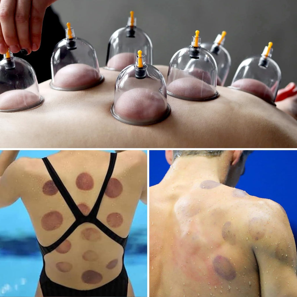 Cupluw Cupping Therapy Kit with Magnetic Cups

