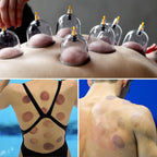 Cupluw Cupping Therapy Kit with Magnetic Cups

