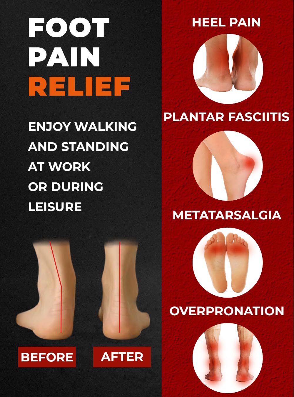 CRUVHEAL Plantar Fasciitis Insoles | Arch Support

